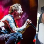 slipknot-corey-taylor-surgery